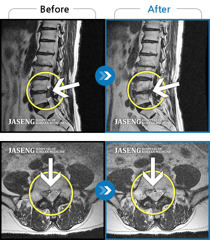 ϻڻѹ溴 ġ MRI  ġ-ó    ̰  ,  ٸ ٷ   ϵ ־ ߸  Ȱġ , ߰ ᵵ  ڰ  Ͽ  Ȱ  ¼̽ϴ. 