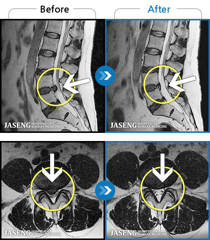 ڻѹ溴 ġ MRI ġ- 㸮 ġ , ٸ ϰ .