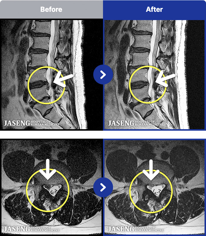 �����ڻ��ѹ溴�� ġ���� MRI�� ���� ġ����-���� �㸮 ��� ����. ���� ���� �����, ���� ���� �ٷ����Ϸ� �ϻ� ��Ȱ �Ұ���.