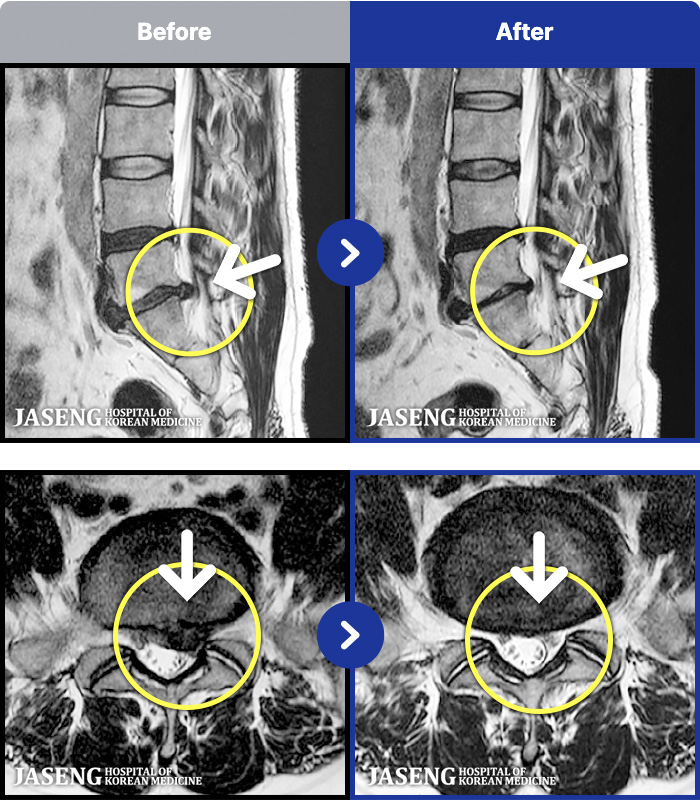 �����ڻ����ǿ� ġ���� MRI�� ���� ġ����-�㸮���� �� ���� �ٸ� �������� ���� ���ϰ� �ϻ��Ȱ�� �Ұ����߽��ϴ�.
