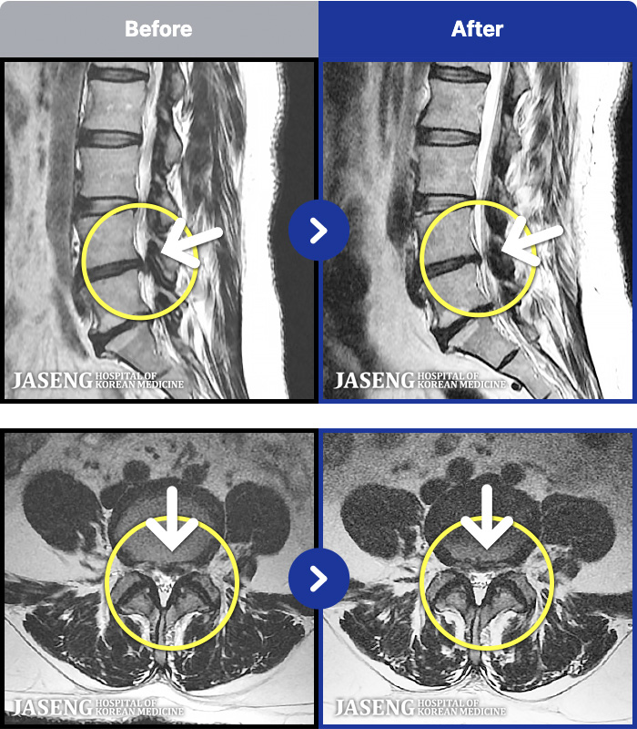 �ڻ��ѹ溴�� ġ���� MRI�� ���� ġ����-���� �㸮, ���, ���� ���� �������� �ؽ��� ������ ������ ���ϰ� �ϻ��Ȱ�� �Ұ����� ���¿����ϴ�.