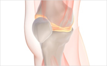 해운대자생한방병원 무릎질환 무릎점액낭염-무릎점액낭염 관련 사진 입니다.