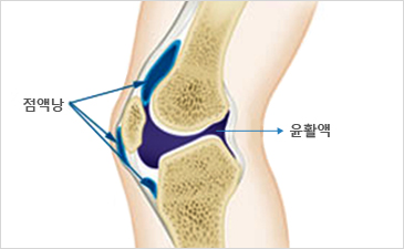 해운대자생한방병원 무릎질환 무릎점액낭염-점액낭과 윤활액이 위치해 있는 무릎 설명 이미지