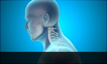 해운대자생한방병원 목질환 일자목증후군-정상적인 C자형 목뼈 모습입니다.