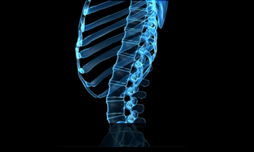 해운대자생한방병원 허리질환 척추전만증-정상적인 사람의 척추 모습입니다.